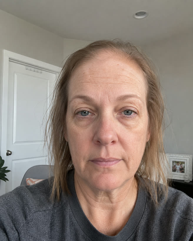 Anna L. przed