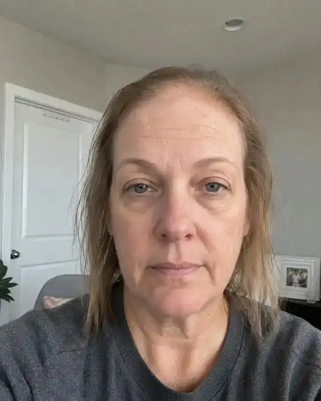 Anna L. przed