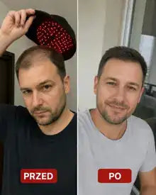 Efekt przed i po u klienta