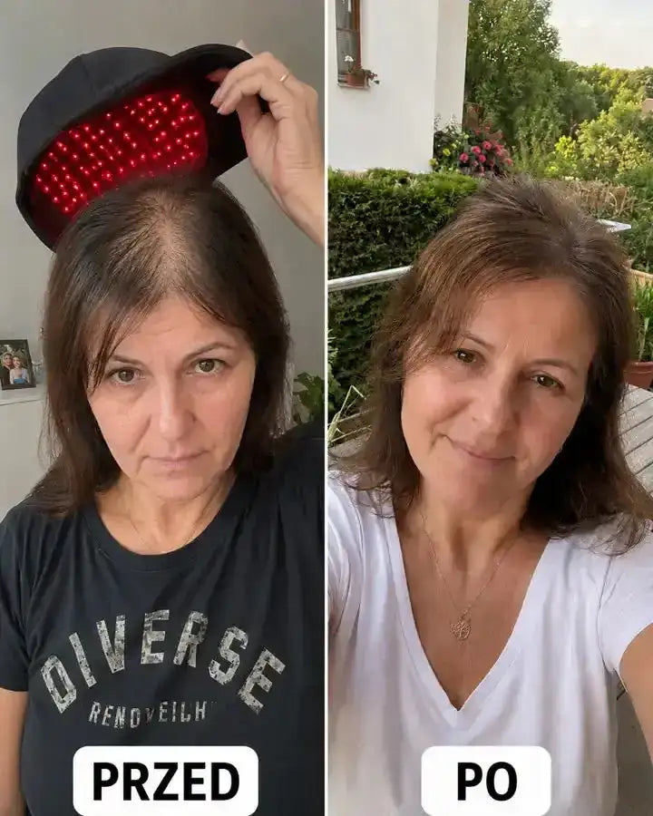 Kobieta przed i po terapii Czuprynka